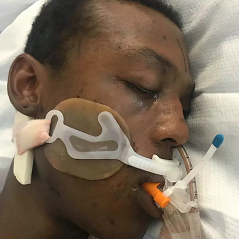 Image: Elijah McClain after his encounter with Aurora police officers.