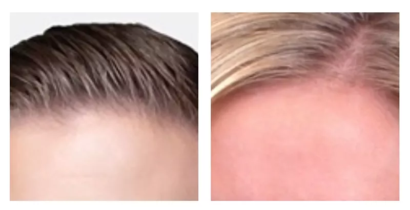 Image: Teasing our 2022 Best Hair winners.