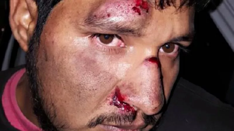 Image: Jaime Alberto Torres after being face-planted by an Aurora police officer.