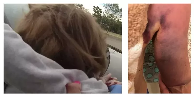 Image: Body camera footage of Karen Garner being taken into custody and a photo of her injured arm.