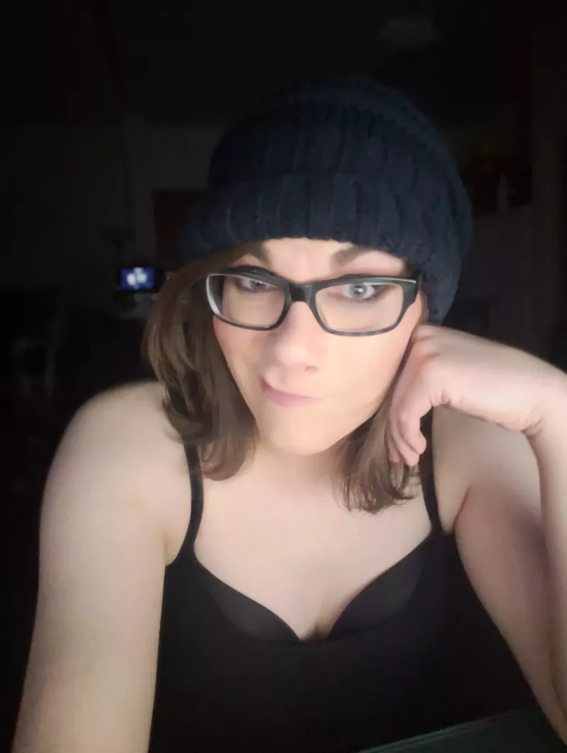 Image: Stacia Hoskins, a transgender woman, is seeking to undergo facial feminization surgery — if her insurance will cover it.