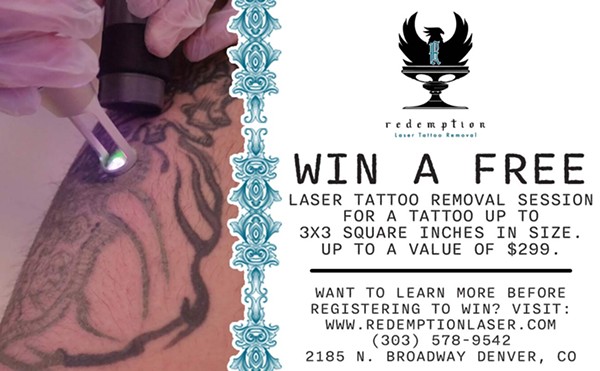 Enter to Win a Laser Tattoo Removal Session!