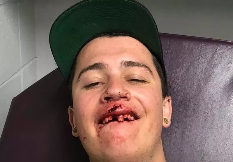 Image: Garth Jacob was punched at a Joe Russo's Almost Dead concert at Red Rocks.
