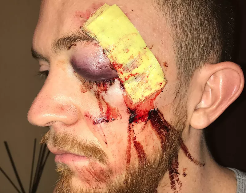 Image: Joey Oertli was assaulted after Winter on the Rocks at Red Rocks Amphitheatre.