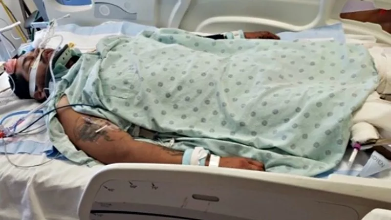 Image: David Montoya after his moped accident on August 25.