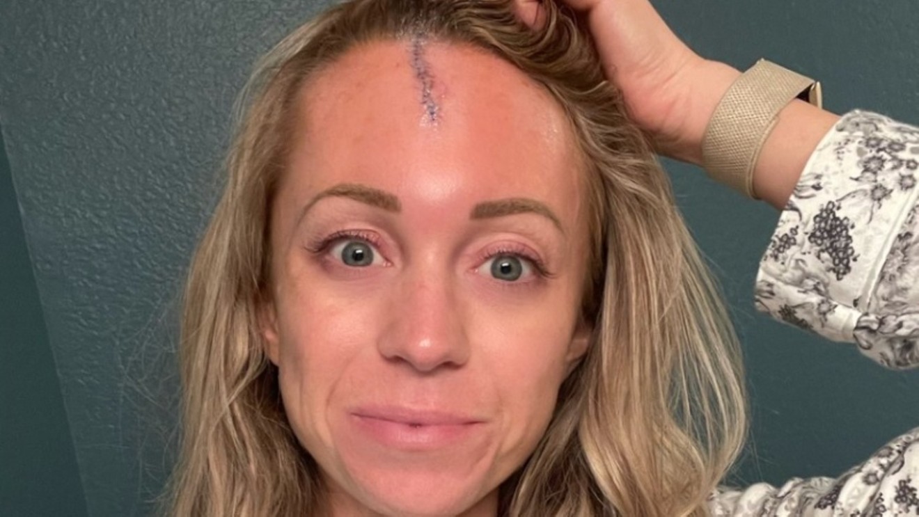 Colorado Rockies reporter Kelsey Wingert showing off her stitches in a photo she shared via Twitter.