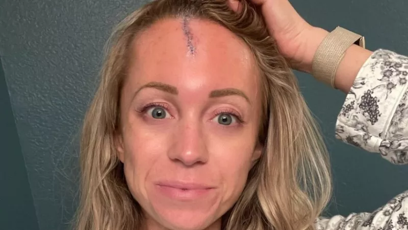 Image: Colorado Rockies reporter Kelsey Wingert showing off her stitches in a photo she shared via Twitter.