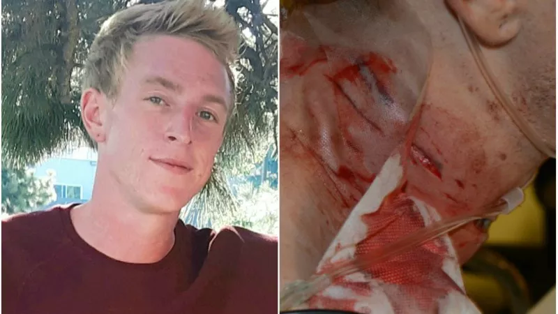 Image: A portrait of Spencer Erickson and a photo of him after he was attacked by a Lakewood police K-9.