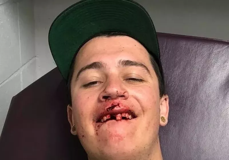 Image: Garth Jacob was assaulted at a Joe Russo's Almost Dead concert at Red Rocks.