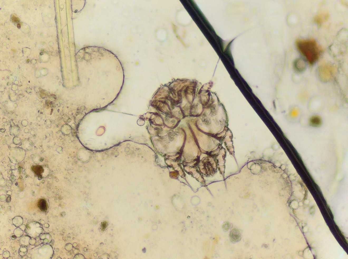 A microscopic view of the mite that causes scabies.