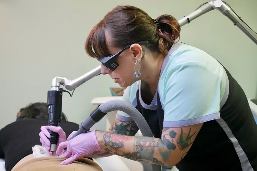 The first in a series of laser treatments that will remove Erin Barnes's "tramp stamp." - LAUREN ANTONOFF