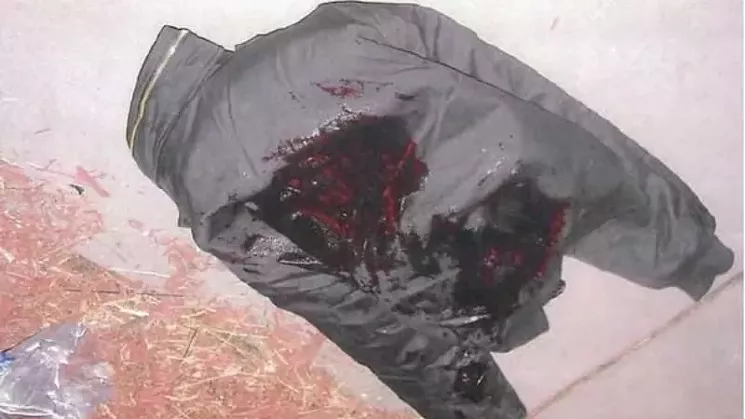 The jacket worn by Alexander Landau as seen after he was beaten by Denver police officers in 2011. - FILE PHOTO