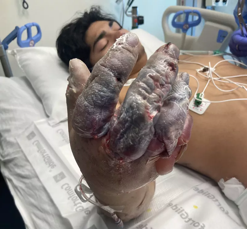 Image: A GoFundMe is raising money to help fund his recovery.