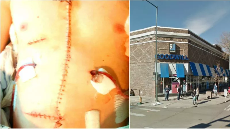 Image: The injuries sustained by C and a look at the Goodwill branch where the stabbing took place.
